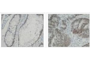 Immunohistochemistry (IHC) image for anti-Heterogeneous Nuclear Ribonucleoprotein K (HNRNPK) (C-Term) antibody (ABIN264512) (HNRNPK 抗体  (C-Term))