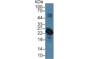 Western Blot; Sample: Rat Spleen lysate; Primary Ab: 5µg/ml Rabbit Anti-Rat VPREB1 Antibody Second Ab: 0. (VPREB1 抗体  (AA 43-128))