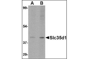 Western blot analysis of Slc35D1 inA-20 lysate with Slc35D1 antibody at (A) 1 and (B) 2 µg/ml. (SLC35D1 抗体  (N-Term))