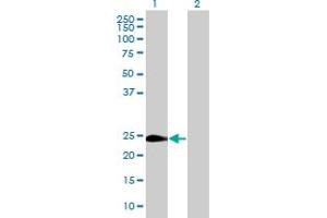 Western Blot analysis of WISP2 expression in transfected 293T cell line by WISP2 MaxPab polyclonal antibody. (WISP2 抗体  (AA 1-250))