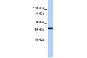WB Suggested Anti-PCDH15 Antibody Titration:  0. (PCDH15 抗体  (N-Term))