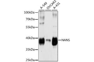 Western blot analysis of extracts of various cell lines, using NANS antibody (ABIN6291679) at 1:3000 dilution. (NANS 抗体)