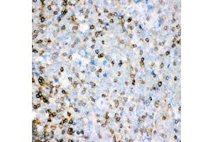 Anti- IL16 antibody, IHC(P) IHC(P): Human Tonsil Tissue (IL16 抗体  (AA 1212-1332))