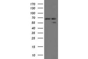 HEK293T cells were transfected with the pCMV6-ENTRY control (Left lane) or pCMV6-ENTRY AFP (Right lane) cDNA for 48 hrs and lysed. (alpha Fetoprotein 抗体)