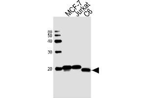 Sample Tissue/Cells lysates probed with antibodyname Monoclonal Antibody, unconjugated (bsm-51413M) at 1:1000 overnight at 4°C followed by a conjugated secondary antibody for 60 minutes at Room Temperature. (NME1 抗体)