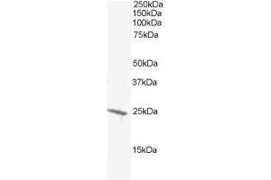 Image no. 1 for anti-BCL2-Antagonist/killer 1 (BAK1) (N-Term) antibody (ABIN374174) (BAK1 抗体  (N-Term))