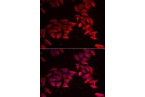 Immunofluorescence analysis of HeLa cell using SFRP4 antibody. (SFRP4 抗体)