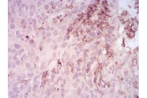 Immunohistochemistry (IHC) image for anti-Matrix Metallopeptidase 14 (Membrane-inserted) (MMP14) (AA 112-246) antibody (ABIN5542659)