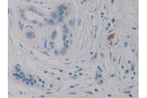 Immunohistochemistry (IHC) image for anti-Interleukin 2 (IL2) (AA 21-153) antibody (ABIN7428635)