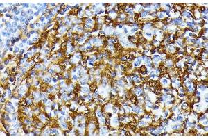 Immunohistochemistry of paraffin-embedded Human tonsil using CSNK1A1 Polyclonal Antibody at dilution of 1:100 (40x lens). (CSNK1A1 抗体)