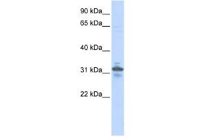 WB Suggested Anti-RPIA Antibody Titration: 0. (Ribose 5-Phosphate Isomerase A (RPIA) (N-Term) 抗体)