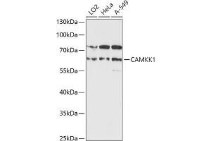 Western blot analysis of extracts of various cell lines, using C antibody (ABIN7266022) at 1:1000 dilution. (CAMKK1 抗体  (AA 399-520))