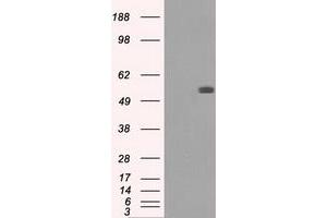 Image no. 2 for anti-Fumarate Hydratase (FH) antibody (ABIN1498269) (FH 抗体)