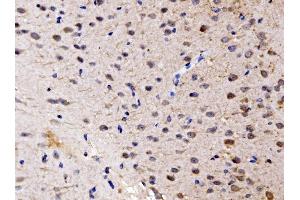 IHC analysis of FKBP135/FKBP15 using anti-FKBP135/FKBP15 antibody (ABIN7600397). (FKBP15 抗体  (AA 19-1210))