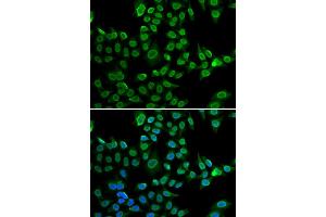 Immunofluorescence analysis of U2OS cell using LMNB2 antibody. (Lamin B2 抗体)
