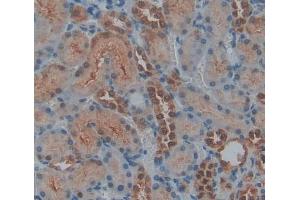 Immunohistochemistry (IHC) image for anti-Protein tyrosine Phosphatase, Non-Receptor Type 14 (PTPN14) (AA 1-188) antibody (ABIN7444970)
