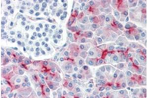 Human Pancreas (formalin-fixed, paraffin-embedded) stained with MUC1 antibody ABIN334252 at 1:50 followed by biotinylated anti-mouse IgG secondary antibody ABIN481714, alkaline phosphatase-streptavidin and chromogen. (MUC1 抗体  (FITC))