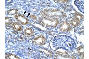 CDK7 antibody was used for immunohistochemistry at a concentration of 4-8 ug/ml to stain Epithelial cells of renal tubule (lndicated with Arrows] in Human Kidney. (CDK7 抗体  (C-Term))