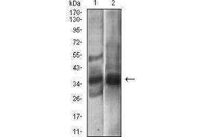 Western blot analysis using EPCAM mouse mAb against A431 (1), MCF-7 (2) cell lysate. (EpCAM 抗体  (AA 24-265))