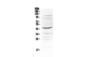 Western blot analysis of IL12B using anti-IL12B antibody . (IL12B 抗体  (AA 23-250))