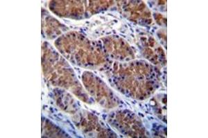 Immunohistochemistry analysis in formalin fixed and paraffin embedded human stomach tissue reacted with Otopetrin-1 Antibody (Center) followed which was peroxidase conjugated to the secondary antibody and followed by DAB staining. (Otopetrin 1 抗体  (Middle Region))