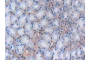 Immunohistochemistry (IHC) image for anti-Albumin (ALB) antibody (ABIN7429667)