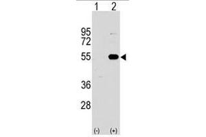 Image no. 2 for anti-Sprouty-Related, EVH1 Domain Containing 1 (SPRED1) (N-Term) antibody (ABIN356947) (SPRED1 抗体  (N-Term))