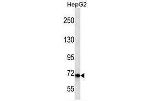 CHD1L Antibody (Center) western blot analysis in HepG2 cell line lysates (35µg/lane). (CHD1L 抗体  (Middle Region))