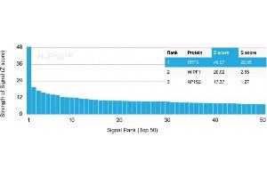 Analysis of Protein Array containing more than 19,000 full-length human proteins using Cytokeratin 5 Mouse Monoclonal Antibody (KRT5/3594). (Cytokeratin 5 抗体  (AA 316-590))