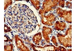 Immunohistochemistry (IHC) image for anti-Glial Fibrillary Acidic Protein (GFAP) (AA 292-432) antibody (ABIN7153847)