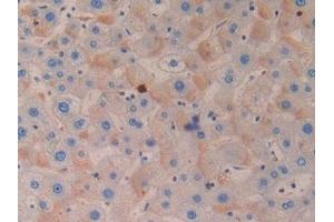 Immunohistochemistry (IHC) image for anti-Azurocidin 1 (AZU1) (AA 23-247) antibody (ABIN7433654)