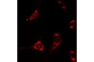 ABIN6275471 staining A549 cells by IF/ICC. (RAB6A 抗体  (Internal Region))