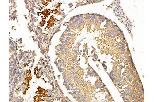 ABIN6264142 and ABIN6266623 at 1/100 staining Mouse testis tissue by IHC-P. (Peripherin 抗体  (C-Term))
