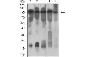 Western Blotting (WB) image for anti-Colony Stimulating Factor 2 Receptor, Beta (CSF2RB) (AA 17-149) antibody (ABIN7193501)