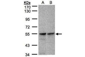 WB Image Sample(30 ug whole cell lysate) A:A431, B:Raji , 7. (FOXRED1 抗体)