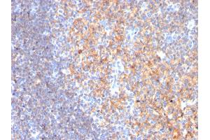 Immunohistochemistry (IHC) image for anti-CD19 Molecule (CD19) (AA 96-281) antibody (ABIN6941101)