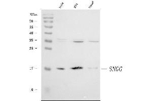 Western blot analysis of gamma Synuclein/SNCG using anti-gamma Synuclein/SNCG antibody (ABIN7602886).