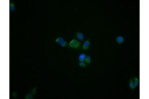 Immunofluorescence (IF) image for anti-Peripheral-Type Benzodiazepine Receptor (TSPO) antibody (ABIN7127858)