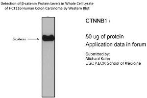 CTNNB1 antibody - N-terminal region (P100600_T100) validated by WB using HCT116 cell lysate CTNNB1 is supported by BioGPS gene expression data to be expressed in HCT116 (CTNNB1 抗体  (N-Term))
