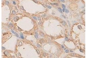Immunohistochemical staining of formalin-fixed paraffin-embedded rat kidney tissue with PLXNB1 polyclonal antibody  at 1 : 100 dilution. (PLXNB1 抗体  (N-Term))
