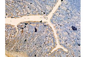 ABIN7094511 and ABIN7098560 at 1/100 staining Rat colorectal tissue by IHC-P.