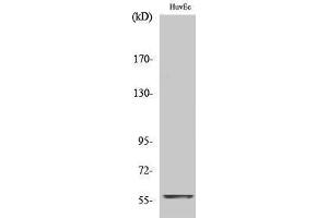 Western Blotting (WB) image for anti-Myc Proto-Oncogene protein (MYC) (C-Term) antibody (ABIN3183980)