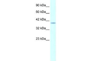 WB Suggested Anti-HMX1 AntibodyTitration: 5. (HMX1 抗体  (Middle Region))