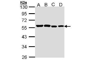 WB Image Sample (30 ug of whole cell lysate) A: A431 , B: H1299 C: Hela D: Hep G2 , 10% SDS PAGE antibody diluted at 1:1000 (TRF1 抗体  (C-Term))