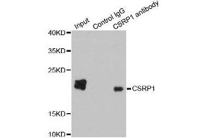 Immunoprecipitation (IP) image for anti-Cysteine and Glycine-Rich Protein 1 (CSRP1) (AA 1-193) antibody (ABIN3021360)
