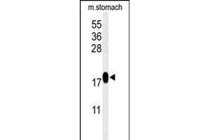 Western Blotting (WB) image for anti-Thioredoxin Domain Containing 12 (Endoplasmic Reticulum) (TXNDC12) (AA 144-172), (C-Term) antibody (ABIN651065)
