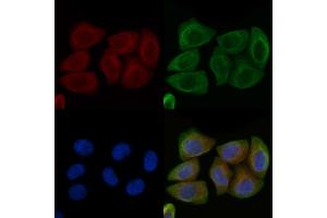 ABIN6261379 and ABIN6266779 staining Hela cells by IF/ICC. (DUSL2 抗体  (C-Term))