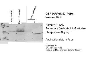 Western Blotting (WB) image for anti-Glucosidase, Beta, Acid (GBA) (C-Term) antibody (ABIN2788767)