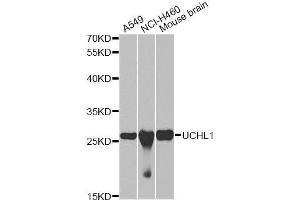Western blot analysis of extracts of various cell lines, using UCHL1 antibody. (UCHL1 抗体  (AA 59-223))