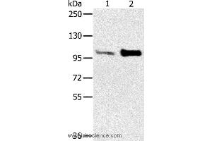Western blot analysis of Mouse muscle and heart tissue, using ACTN2 Polyclonal Antibody at dilution of 1:300